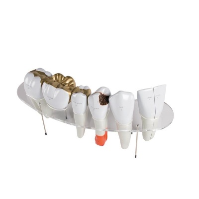 Enlarged Dental Morphology Model